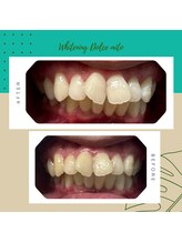 ドルチェ 水戸店(Dolce)/4来店ブライダルコース★