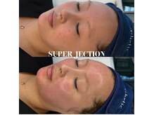 チェリッシュ フェイス 藤沢(CHERISH FACE)の雰囲気（小顔/リフトアップフェイシャル/毛穴/湘南/藤沢）