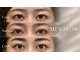 ミュー ブロー(MEW BLOW)の写真