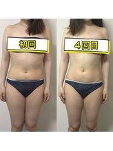 エステサロンクオーツ/オールハンドで骨格調整！