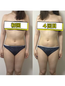 エステサロンクオーツ/オールハンドで骨格調整！