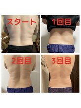 リラクゼーションサロンネロリ/本気痩身　背中だって変わります
