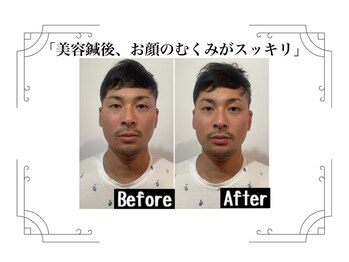 鍼灸整体院ユー(鍼灸整体院You...)/before/after