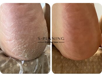 ロンディネ(Rondine)/足裏角質ケア