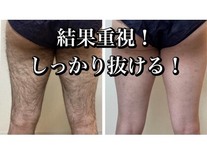 アンド エヌ(&n)の写真