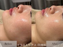 シェリーミル(Cherie Miru)/美白/シミケア/赤みケア