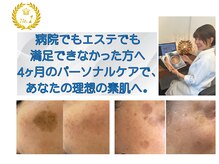 ノンノン(NonNon)