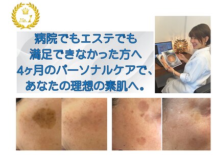 ノンノン(NonNon)の写真