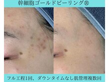 リメイククリニカルビューティー(Remake clinical beauty)/