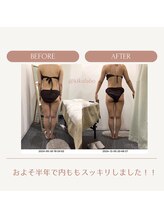 効くラボ 新宿店/下半身集中ケア痩身！