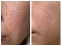 ペリドット(Peridot)/