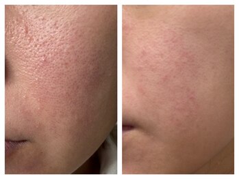 ペリドット(Peridot)/