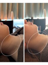 エルミオ エスパシオ ミロク(El mio espacio 369miroku)/CARBOXY～お首編～