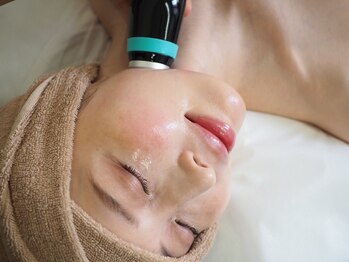 リフト 柏(Lift)の写真/【直後から速実感！】最新韓国式小顔マシン×毛穴洗浄で小顔と美肌を同時にGET★口横ポニョの改善にも◎