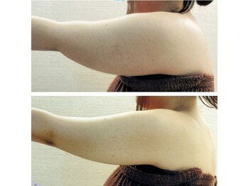 デイスパ ヴィータ/before after