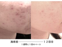 あるしあ鍼灸接骨院 木曽川院/〈一宮/木曽川町/岐阜/整体〉