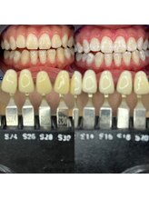 トウキョウスワーズ 池袋店(TOKYO SWRS)/#ホワイトニング #池袋 #渋谷