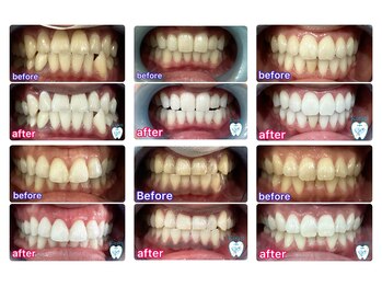 キラット 札幌中島公園店(Kiratt)/当店のお客様初回before.after