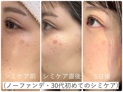 ラウレア(LAULEA)の写真