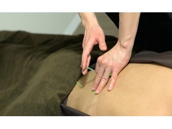 ビハダ(BIHADA)/肩こり・腰痛にはオーダー鍼灸！