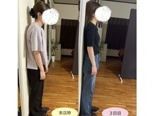 ブライダルに向けて【美姿勢矯正】美しいドレス姿へ♪