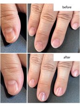 ケアプラス(care plus)/ハンドネイルケア