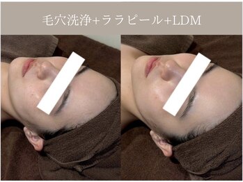 リィ プラス(Riii plus)/【韓国肌管理】