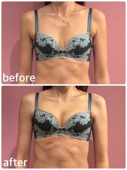 ククナ 上越店(KUKUNA)の写真/細身さんもあきらめないで！"私でも変われるかも！"を一緒に叶えます♪