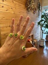 アルバ暁子鍼灸治療院(alba暁子鍼灸治療院)/お灸