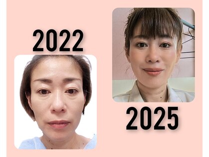そらの写真