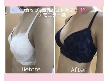 エステティック　レイビス 渋谷店(RAYVIS)/2カップUP！巻き肩改善も♪