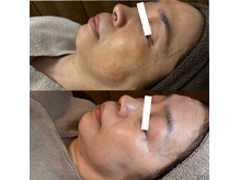 エステドルース(esthe de Ruth.)の雰囲気(当店人気【Ruth.オーダーメイドケア】【Ruth.会員様】ございます)