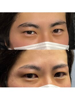 ブリス 姫路(Bliss)/お客様Before/After