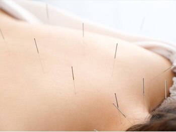 アイリス鍼灸接骨院の写真/【地域に寄り添う鍼灸接骨院◎】手技では取り切れない不調を鍼灸で改善*松陰神社前駅から徒歩1分