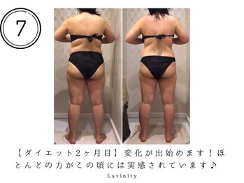 ラヴィニティ 池袋店(Lavinity)/効果の実感は2ヶ月目頃から!