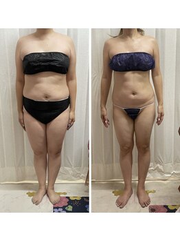 ビューティーショップ リアン(RIAN)/ブライダルエステ