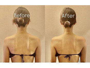 サロン ド プレシャス(Salon de Precious)/整体リンパマッサージ/肩こり◎