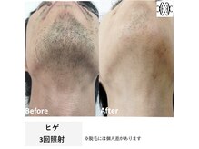 フェリマ ナナ(felyma vii)の雰囲気（一度で感動の変化！他脱毛から移行の方多数結果が全てのTHR方式）