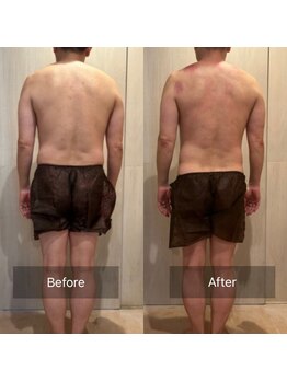 アリッチ 岡崎店(a.Rich)/デスクワークの背中の丸み