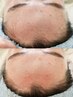 おはだ【毛穴ってなに？毛穴レスなツヤ肌】ツヤたまご肌フェイスWAX  ¥6500