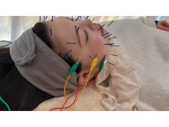 瑞 鍼灸院/美容鍼×セルサー