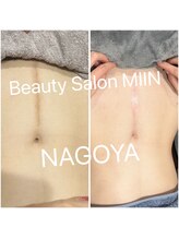 ミイン(美in)/ローマピンク 正中線