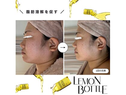 アリュール(Allure)の写真
