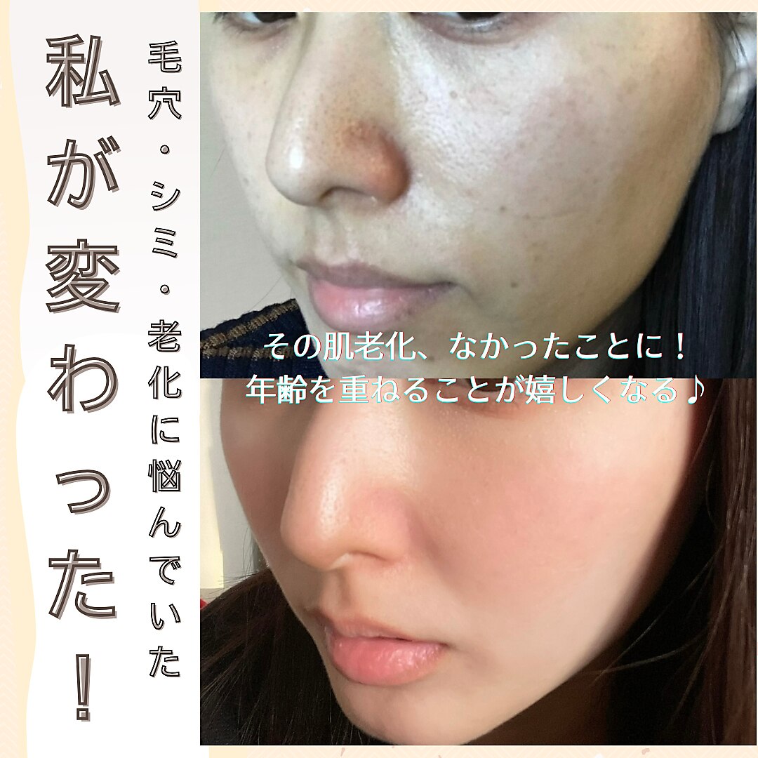 吉成駅でピーリングが人気のエステサロン｜ホットペッパービューティー