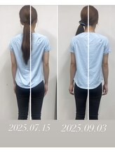 サンアップ(Sun UP)/【Before after】１ヶ月４回