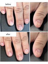 ケアプラス(care plus)/ハンドネイルケア