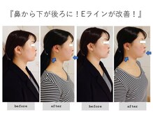 エピファニー(Epiphany)/頭が軽くてびっくりです