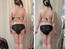 ひぺりかむ/4Day写真《リンパドレナージュ》