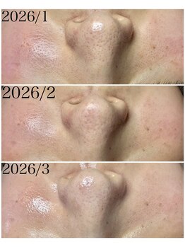 ブラックボックス(BLACK BOX)/20代女性のお客様