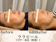 エスポワール(espoir)/before・after